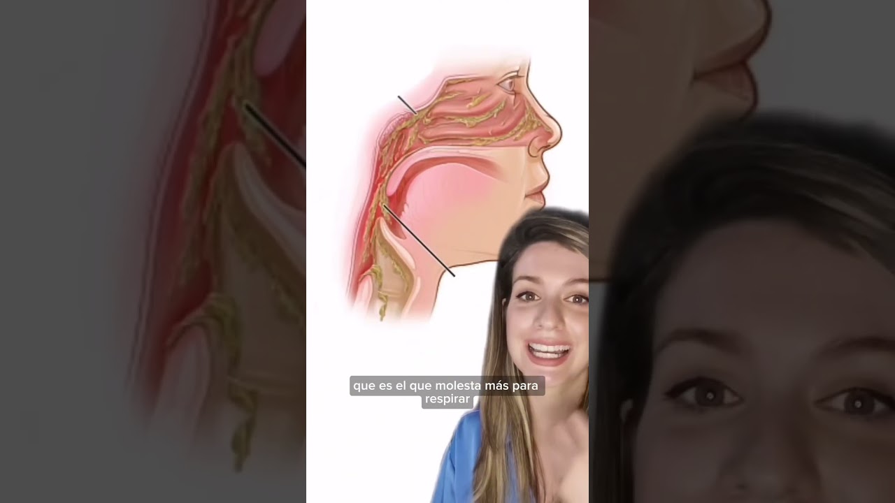 Lavados nasales en beb&eacute;: &iquest;qu&eacute; pasa si no sale moco por el otro agujero?