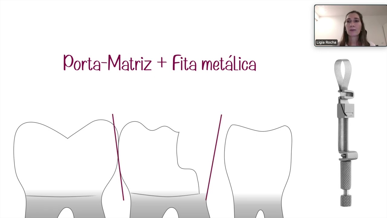 MasterClass | Margem Profunda. E agora?