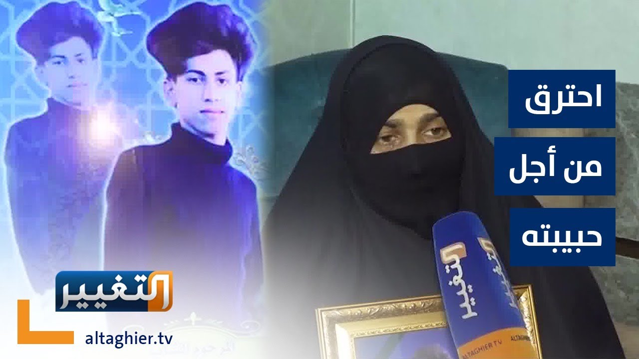 احترق من أجل حبيبته .. حمودي ضحية 