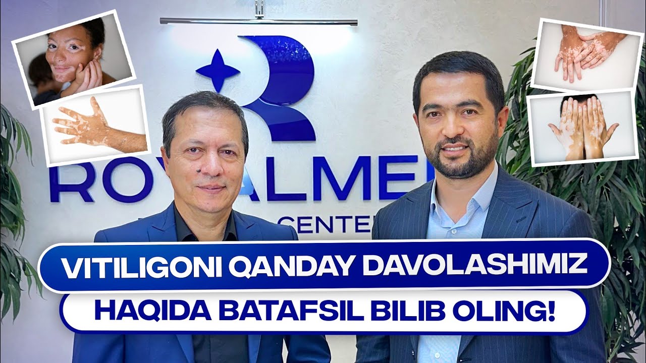 OQ DOG' (VITILIGO) KASALLIGI INNOVATSION KOMPLEKS DAVOLASH USULI HAQIDA