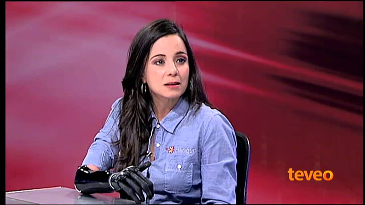 Mujer hispana enfrenta su vida cotidiana con un brazo biónico  - América TeVé