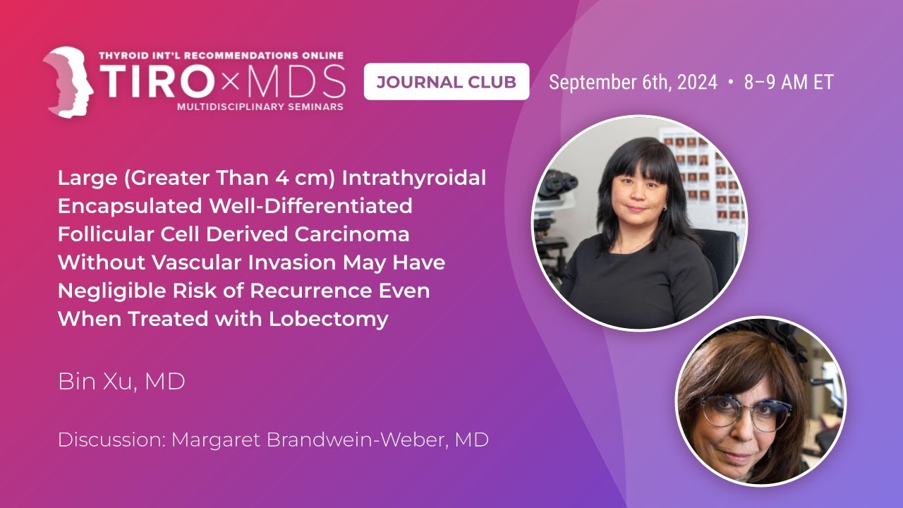 Negligible Recurrence Risk for Large Follicular Thyroid Carcinoma Treated with Lobectomy | Dr. Xu