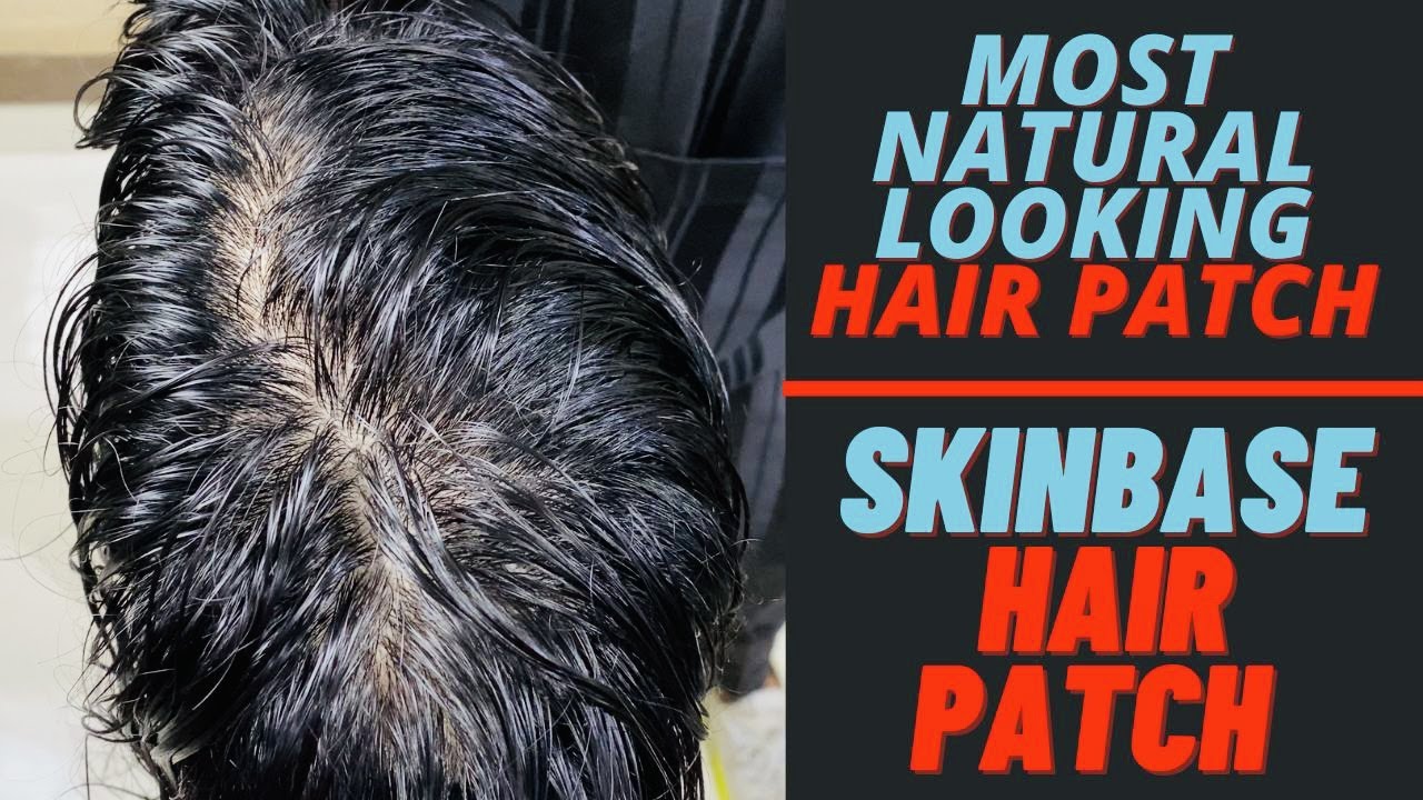 Skin Base Hair Patch | Premium Hair Replacement Unit | Non Surgical Hair Transplant @Hairwighouse