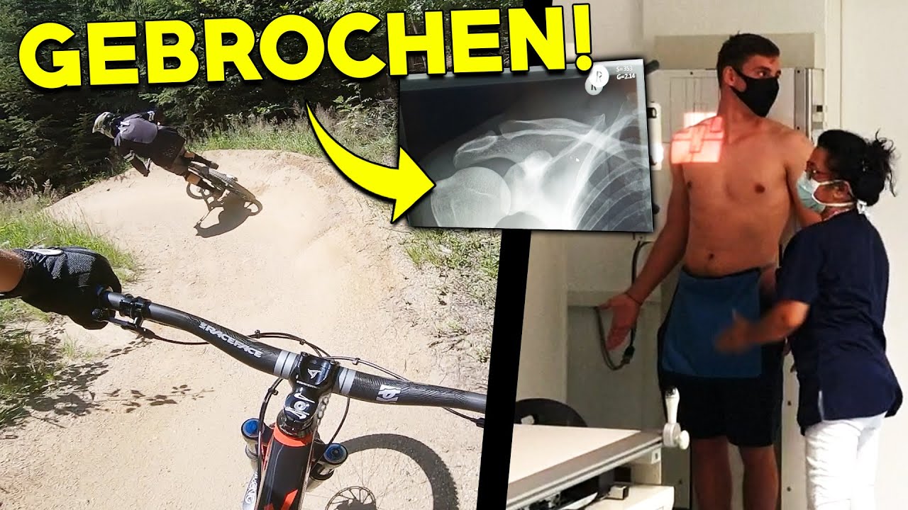 Mein Unfall endet im Krankenhaus...🤕 - Fixx I Felix