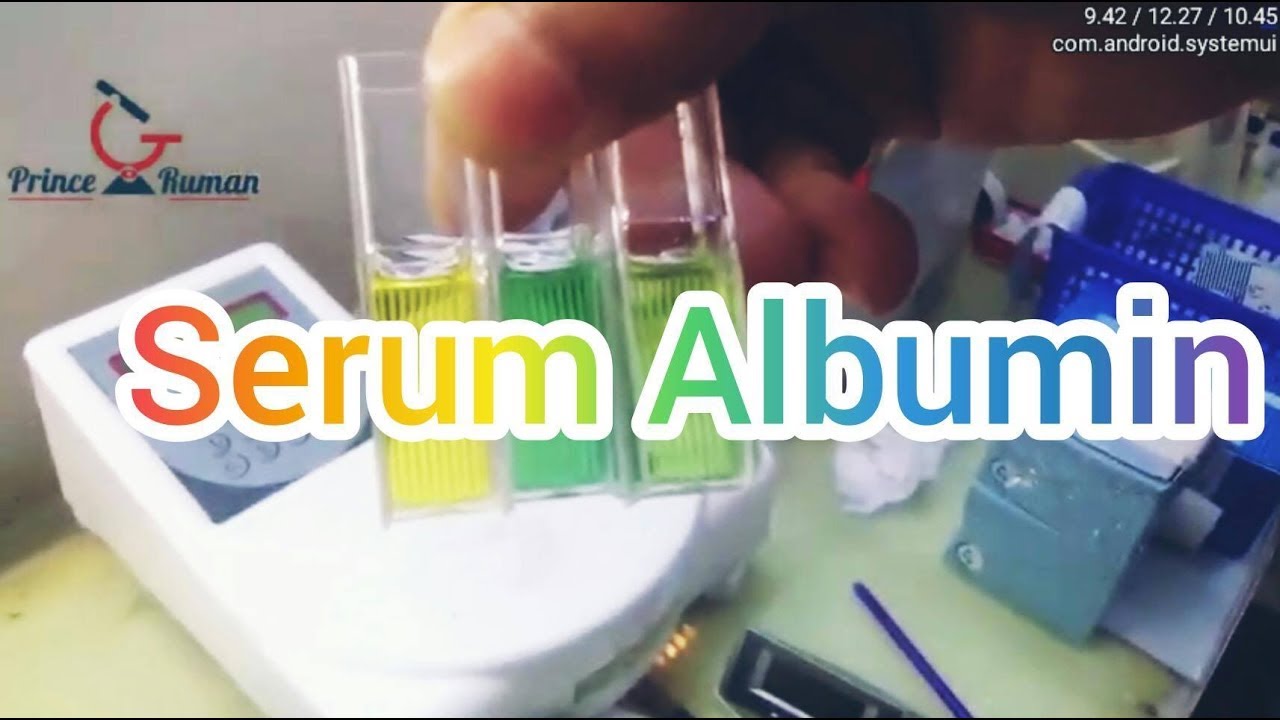 S. Albumin Test Procedure  in bangla. সম্পুর্ন বাংলায়  (Prince Laboratory)