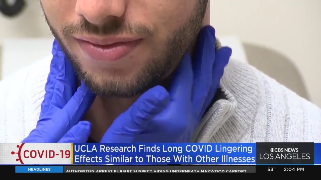 Long COVID effects are similar to other lingering illness symptoms