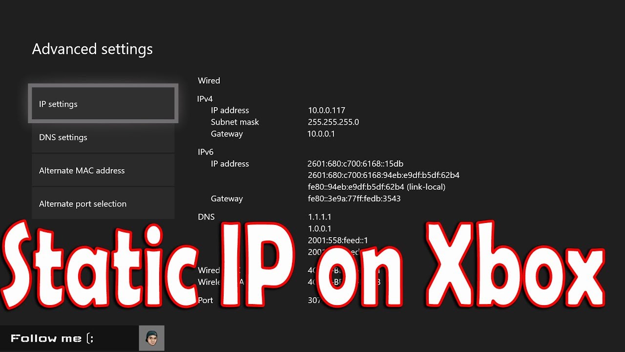 How to Setup Static IP on Xbox One