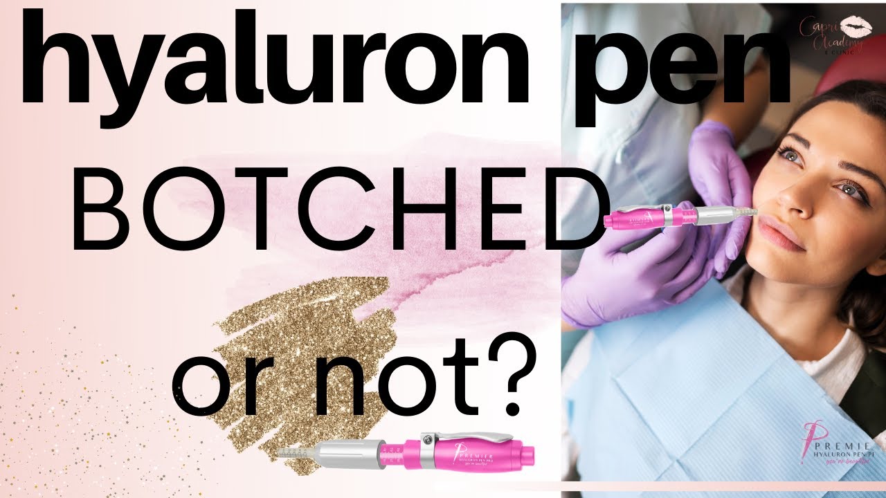 Botched Hyaluron Pen.