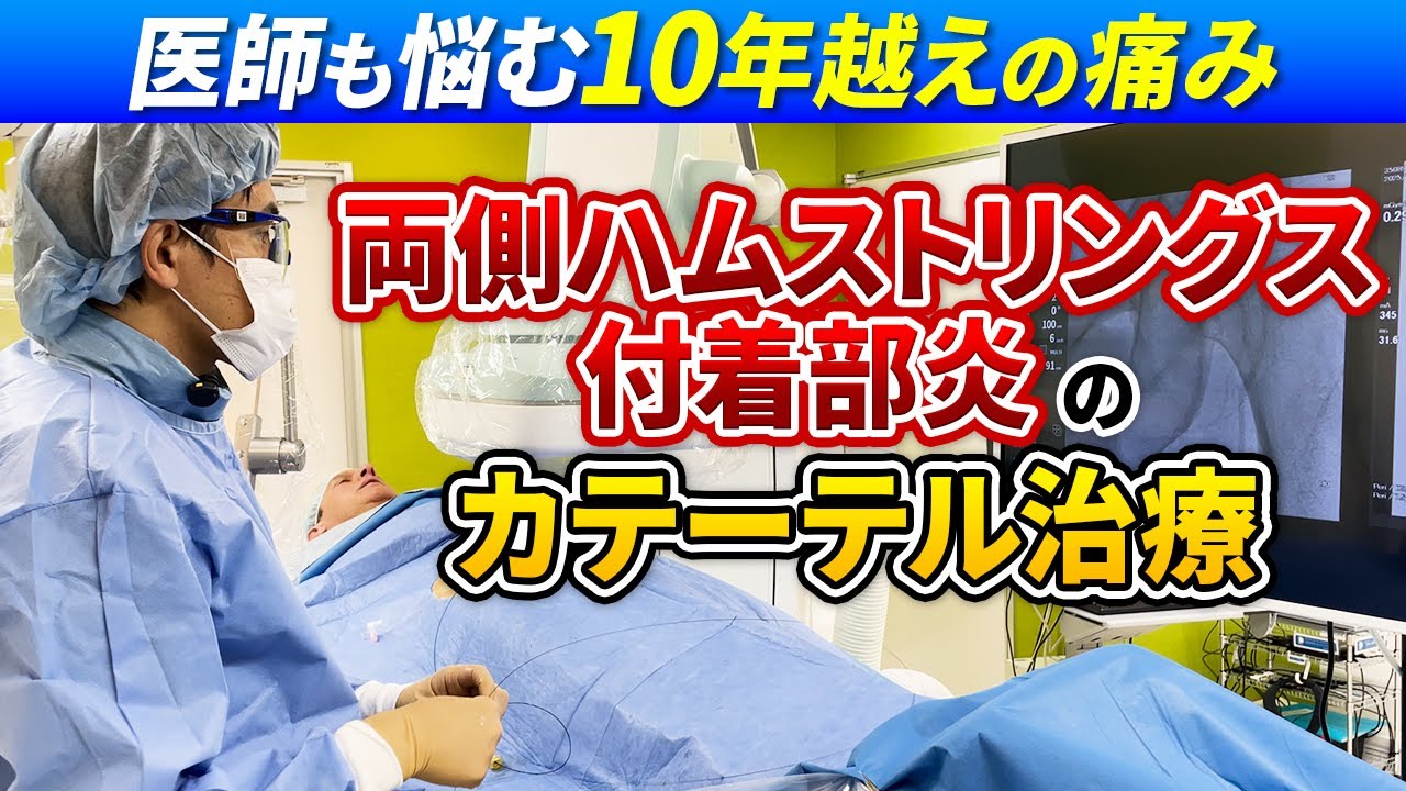 医師も悩む10年続く痛み　両側ハムストリングス付着部炎のカテーテル治療密着動画