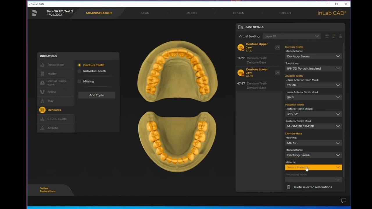 How to Import STL files to inLab CAD 22
