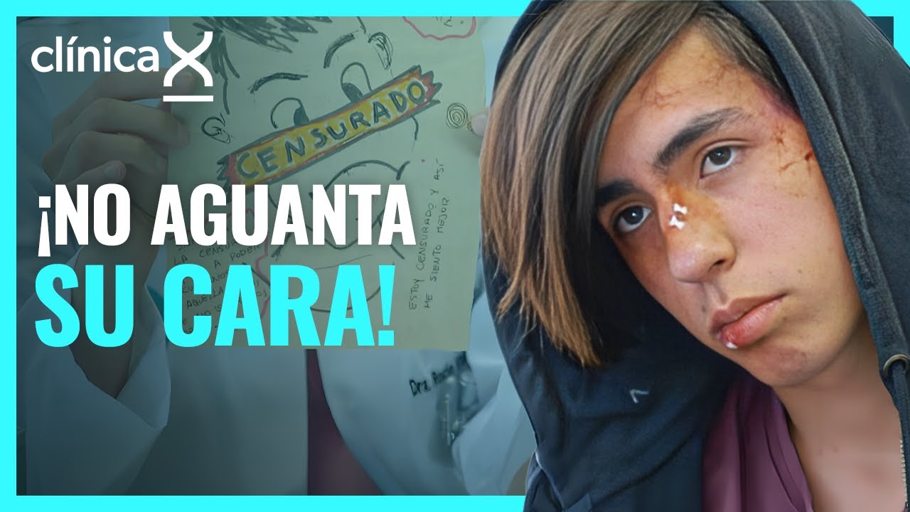 Su cuerpo es su mayor enemigo | Temporada 2 | Clínica X
