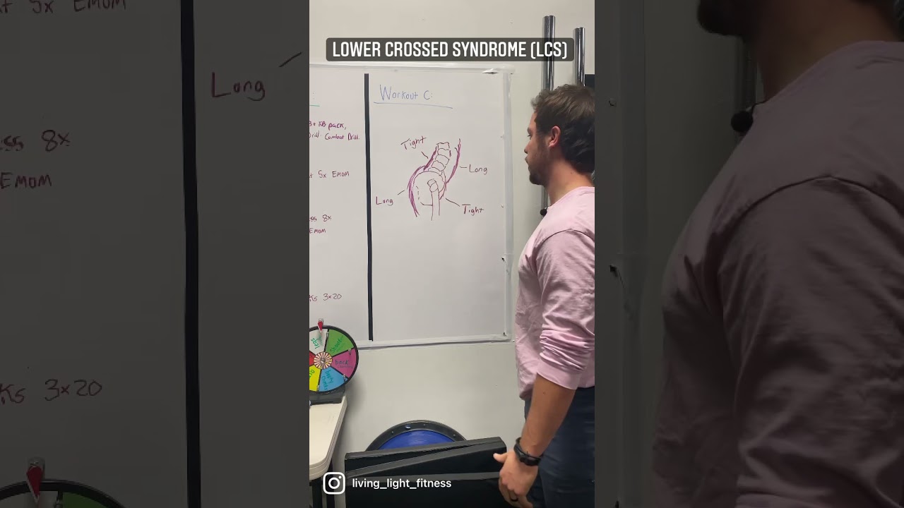 How to Fix Lower Crossed Syndrome