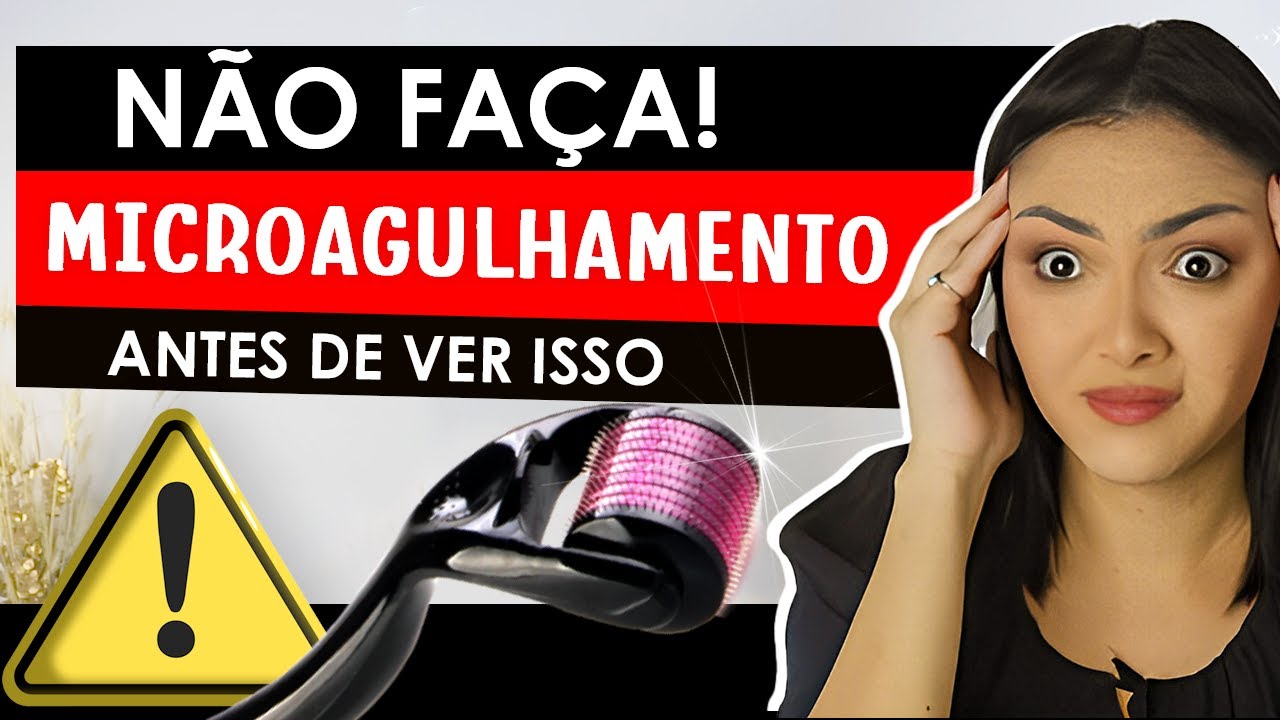 Quais os  perigos de fazer MICROAGULHAMENTO em casa? #dermaroller #skincare  #microagulhamentofacial