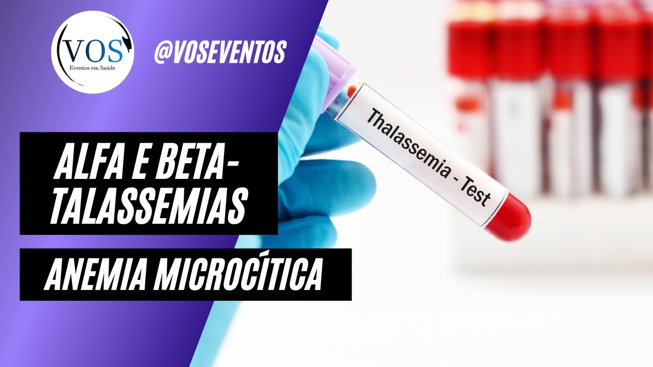 Talassemias (Alfa e Beta) - Anemias Microcíticas