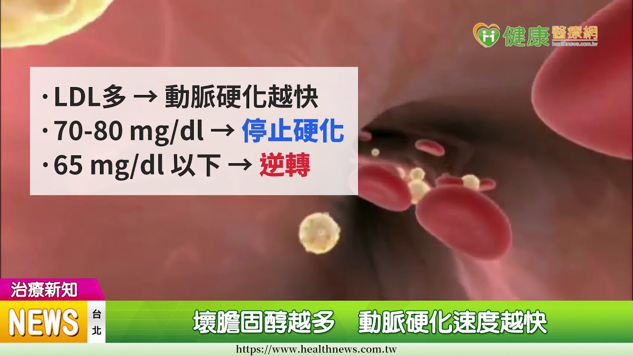 動脈硬化居然可逆轉？　關鍵在「壞膽固醇」