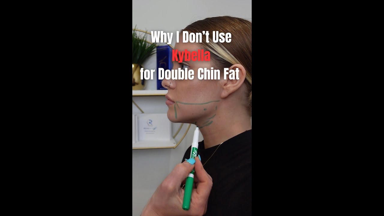 Why I Don&rsquo;t Use Kybella for Double Chin Fat | Better Options
