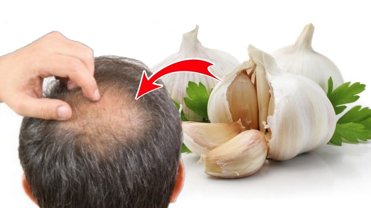 Macsalaaamey tima daadasho iyo gogo'ida || mucjiso timaha si degdeg kuugu dheeraanayan || caafimaad