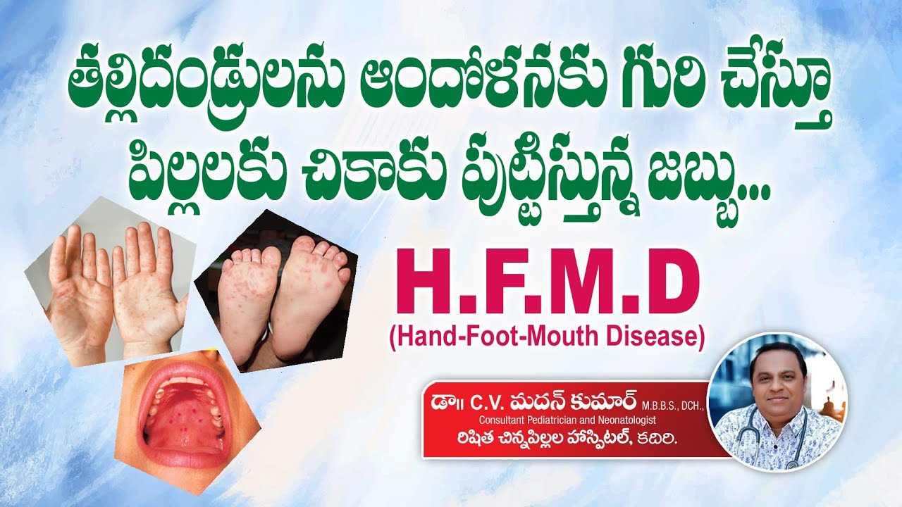 HandFootMouthDisease in babies telugu ||hfmd in telugu|| Hfmd In Kids || Dr Madan kumar.CV|