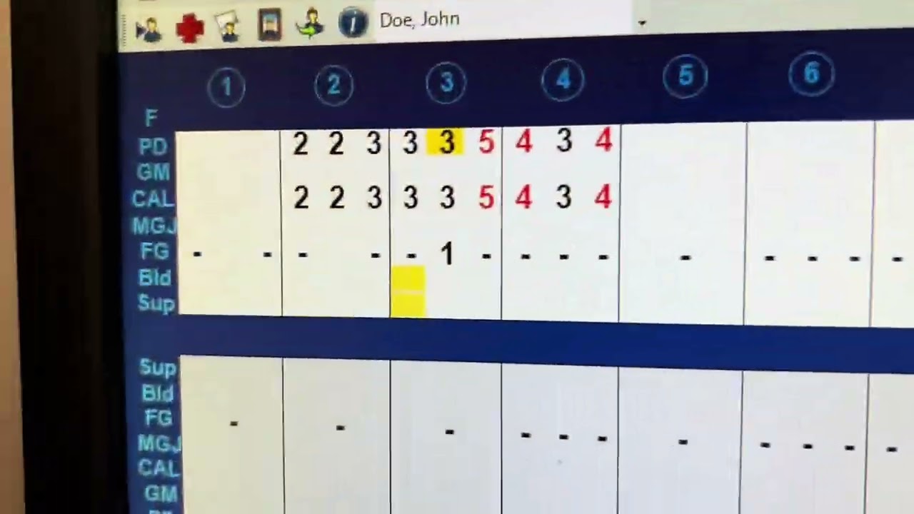 Orientation to Dentrix Perio Charting (probe depth, recession, CAL, MAG, furcations, mobility, etc.)