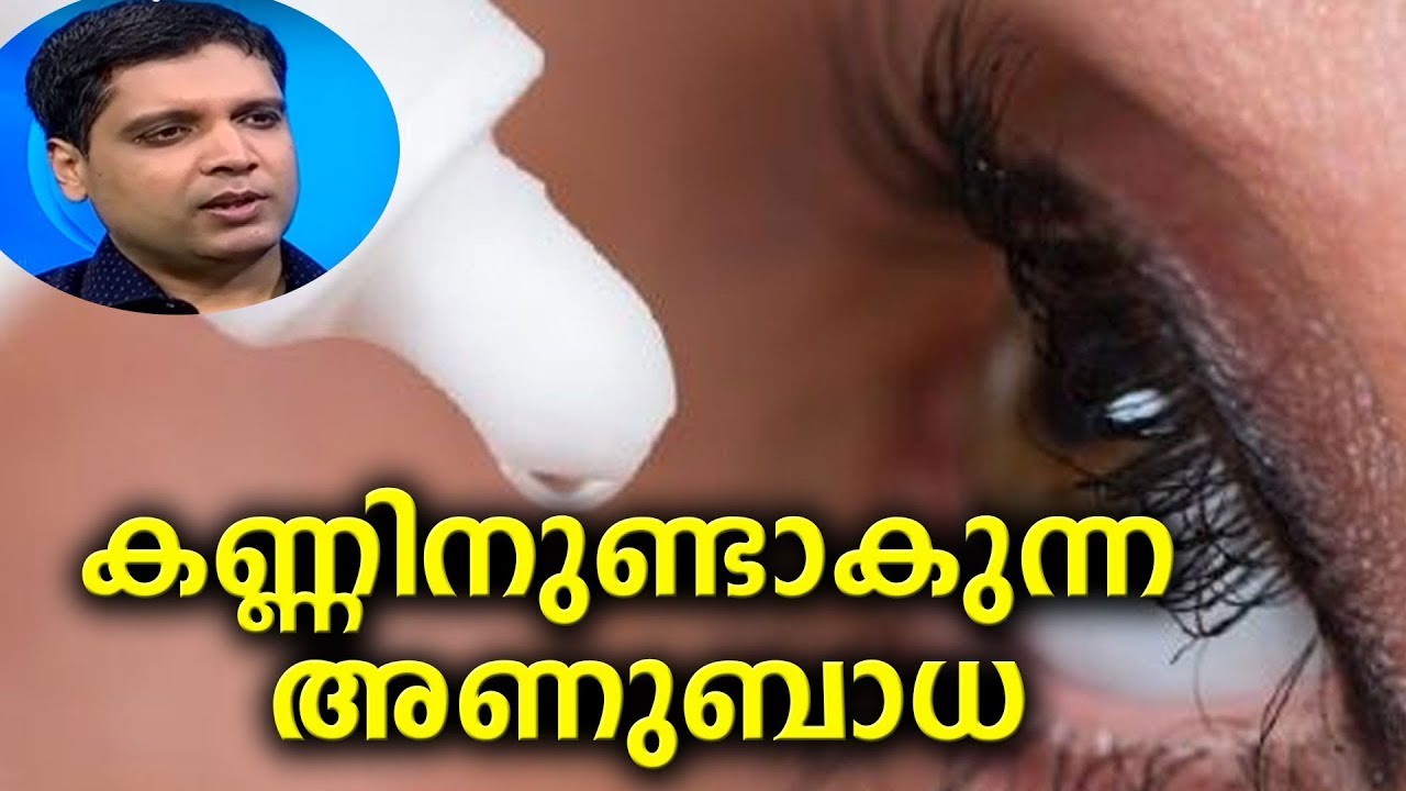Dr. Q : കണ്ണിനുണ്ടാകുന്ന അണുബാധ | Eye Infections |  16th February 2018