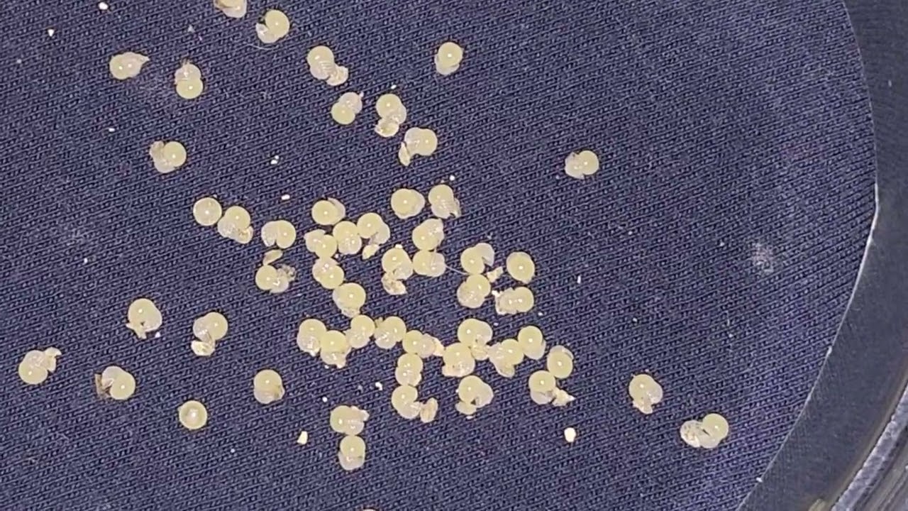 Tarantula Eggs With Legs!!