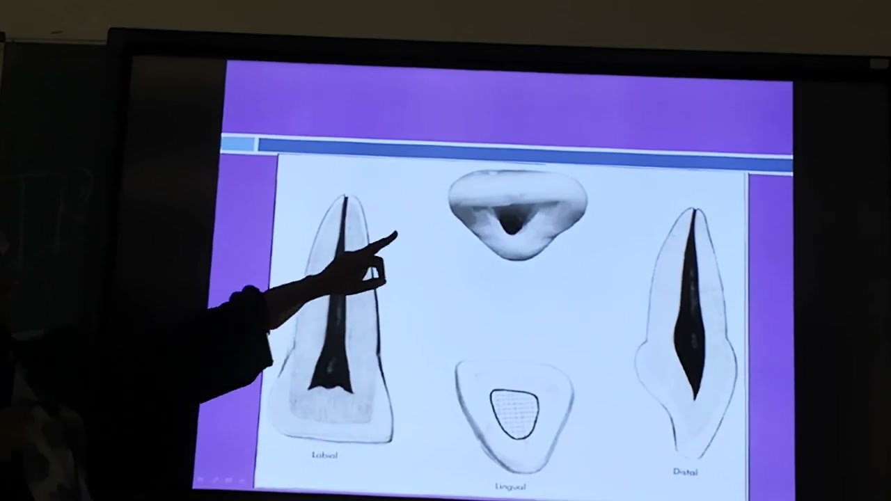 شرح مادة علاج الجذور - Endodontic - للدكتورة هويدا - Tooth Morphology and Access Cavity 3