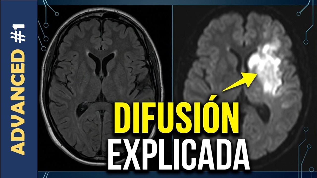 ✅ Secuencia de DIFUSION en Resonancia Magn&eacute;tica. 👌SE ENTIENDE👏👏 Parte 1 Secuencia DTI, DWI