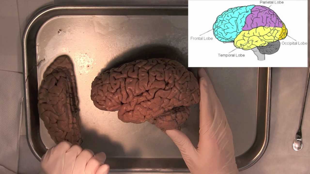 MIT Introduction to Neuroanatomy Series: Part 1