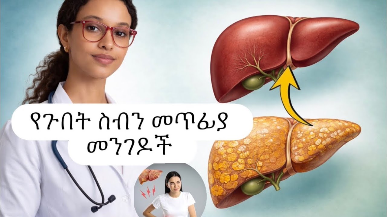 የጉበት ስብን ማጥፊያ መንገዶች (How to reverse liver dx /NAFLD/)
