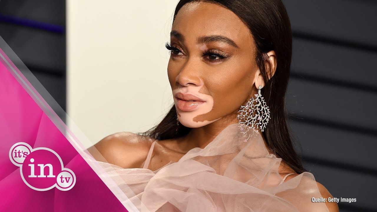 N&auml;chste GNTM-Gastjurorin: Jetzt kommt Model Winnie Harlow