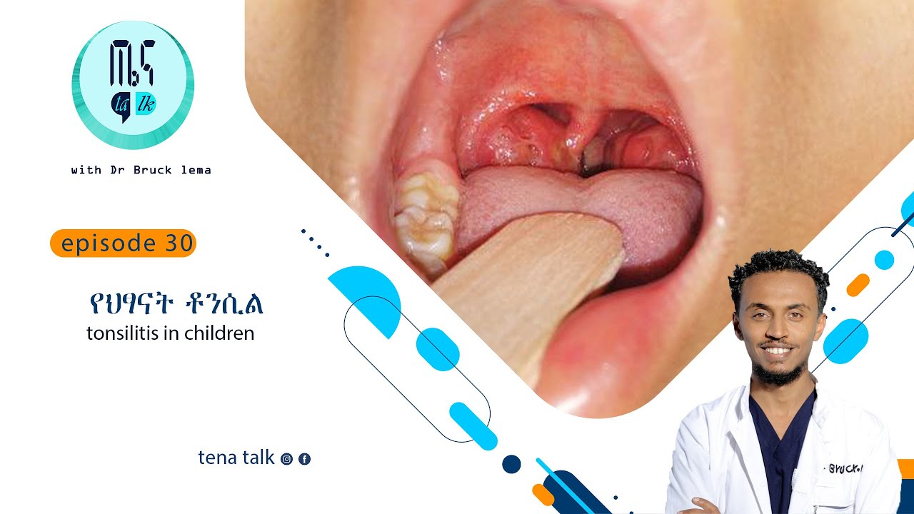 ETHIOPIA የህፃናት ቶንሲል tonsillitis in children