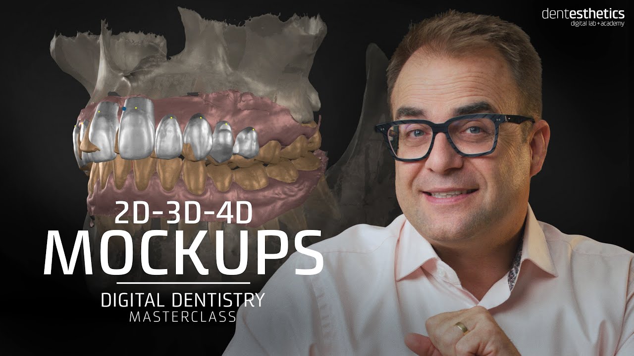 Test a New Smile BEFORE the Dental Treatment