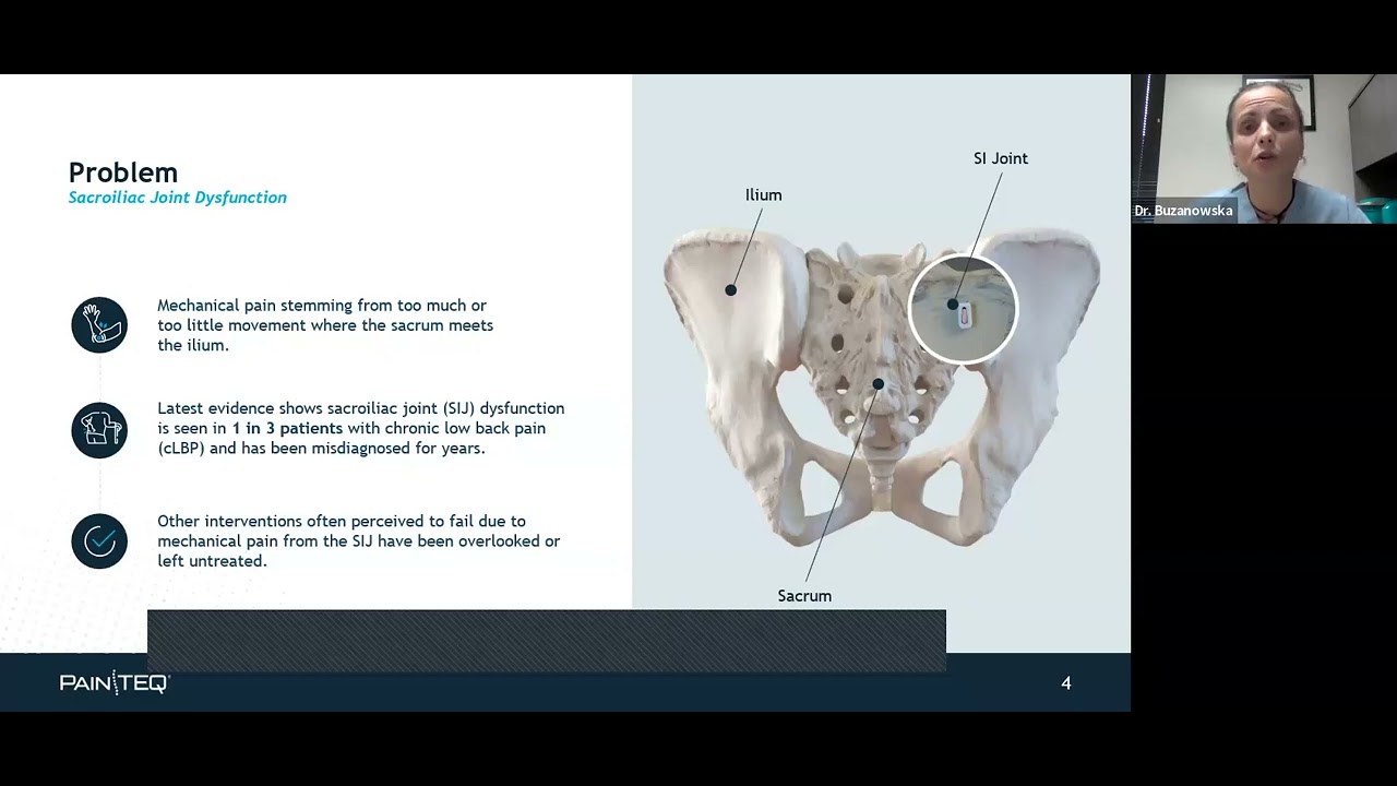Webinar: Minimally Invasive Procedure for SI Joint Pain. LinQ Procedure from PainTEQ
