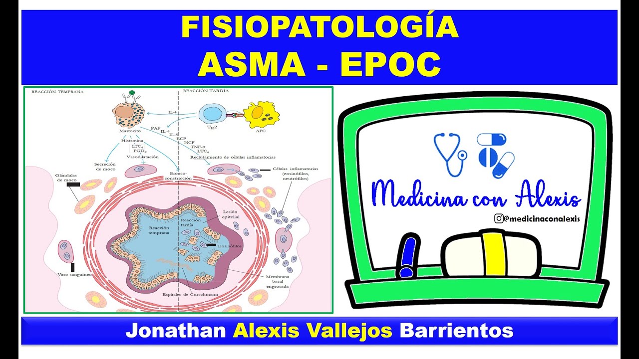 ASMA Y EPOC - FISIOPATOLOGÍA Y CLÍNICA