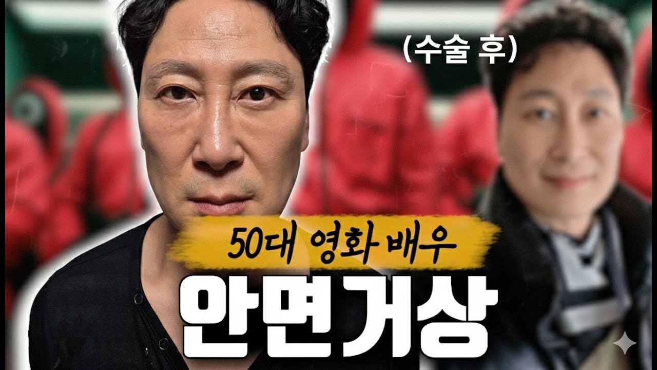50대 영화배우가 안면거상을 한다면?🔥#안면거상 #주름 #노안