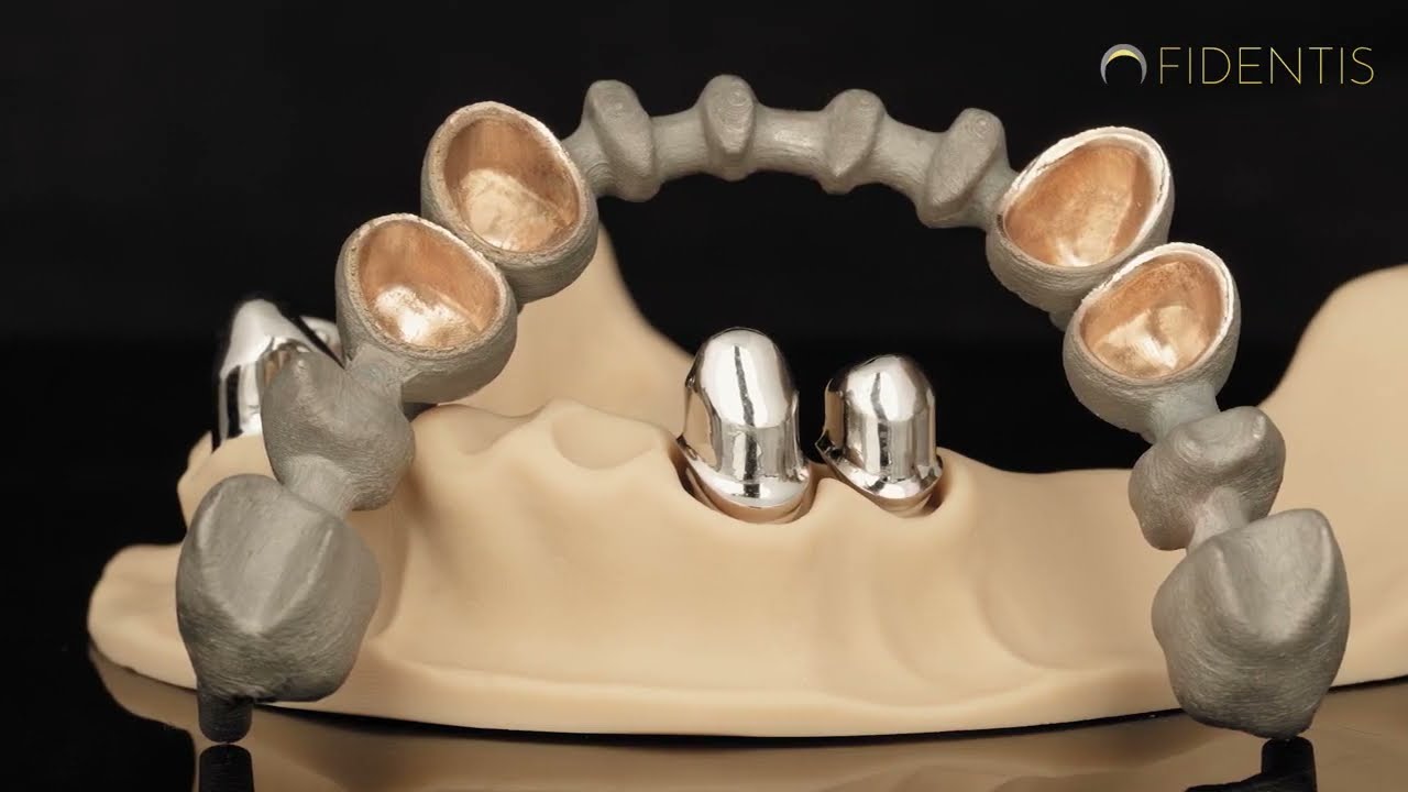 FIDENTIS German Crown