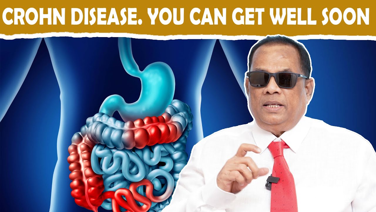 CROHN DISEASE. YOU CAN GET WELL SOON / CKN