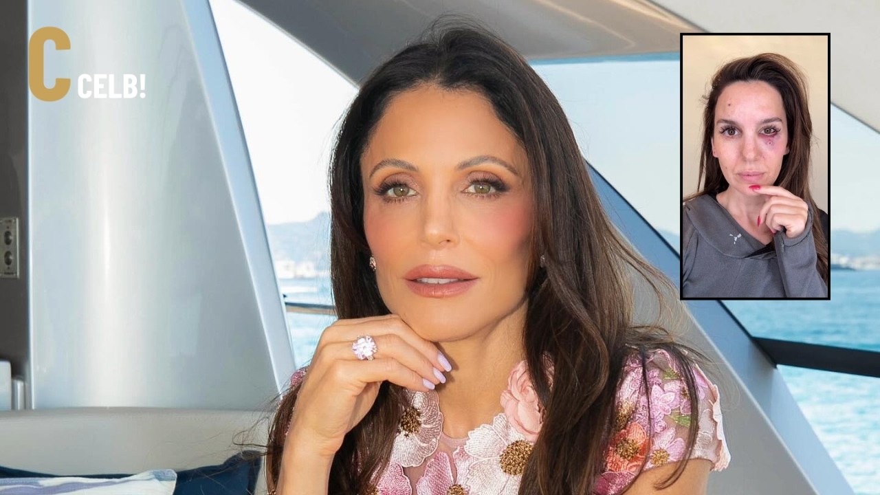 Bethenny Frankel Reveals Painful Infection During St. Barths Vacation