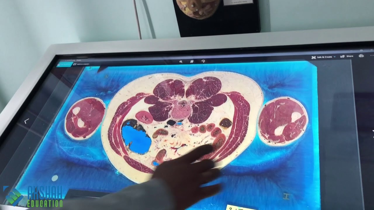 Advanced Interactive Media Table | Ternopil State Medical University | Ukraine