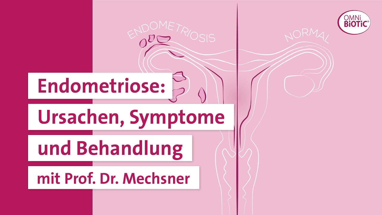 Endometriose erklärt von Prof. Dr. Sylvia Mechsner [OMNi-BiOTiC®]