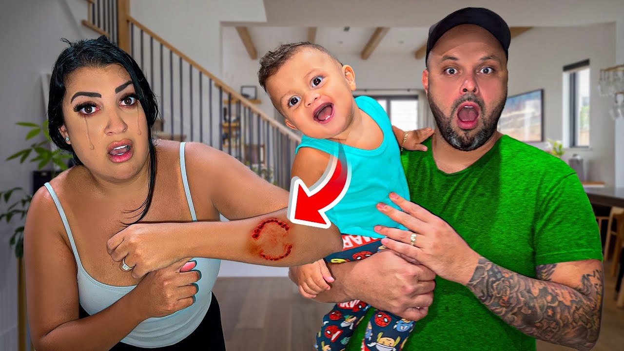 Can't Believe Our Son BIT My HAND!!