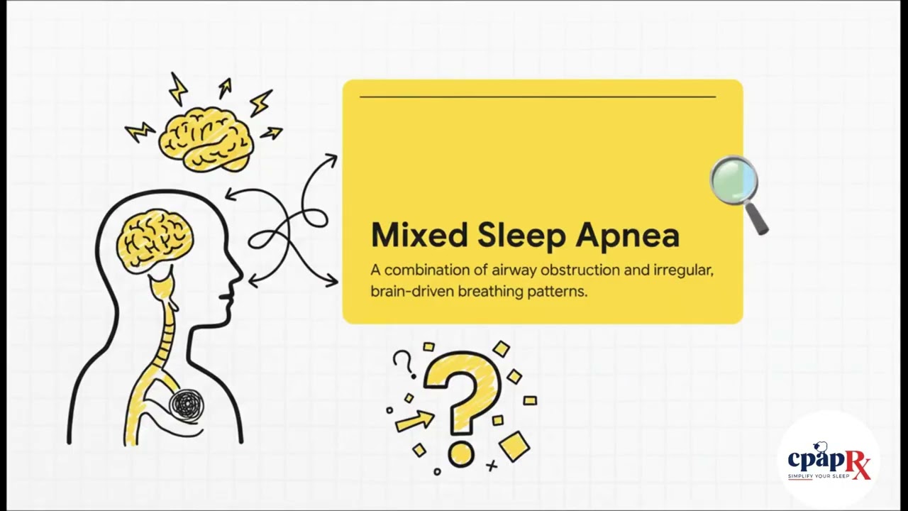 Vblog : Which Sleep Apnea Do You Have? 3 Types Explained Simply #healthtips