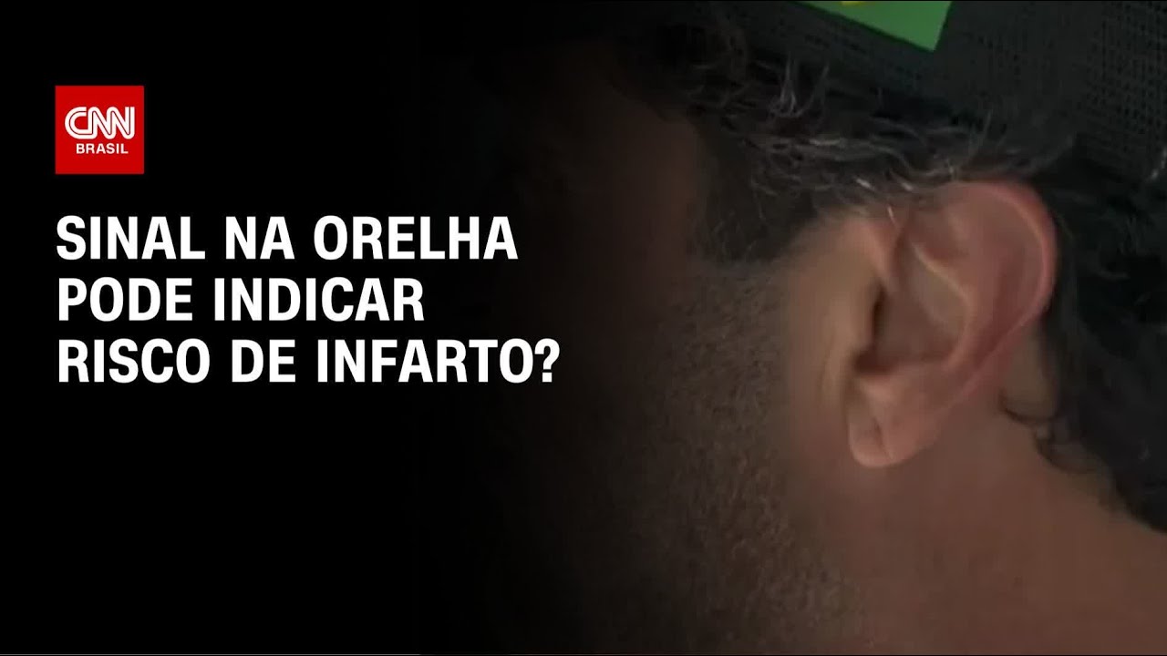 Sinal de Frank pode indicar risco de infarto? Dr. Kalil explica | LIVE CNN