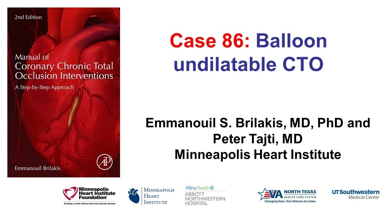 Case 86: Manual of CTO interventions - Balloon undilatable CTO