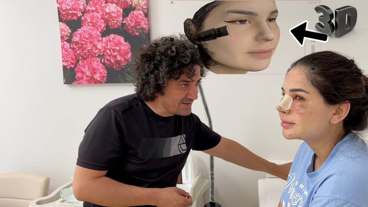 عملت عملية لأنفي | بتقنية جديدة