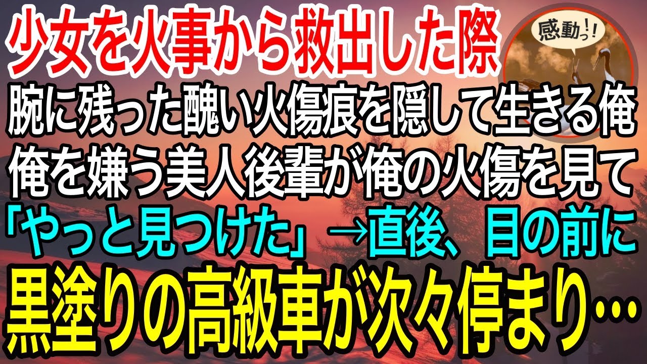 【感動】子供の時に火事現場から少女を救出。その時腕に残った醜い火傷の痕を隠して生きる俺。ある日、俺を嫌う美人後輩「その腕の火傷って…！？」→直後、目の前に黒塗りの高級車が次々停まり…【泣ける・良い話】