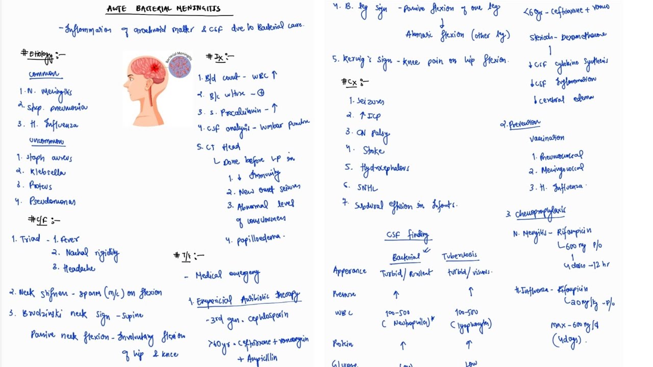 BACTERIAL MENINGITIS NOTES | ONE PAGE NOTES | CNS | MEDICINE | 4TH PROFF | MBBS