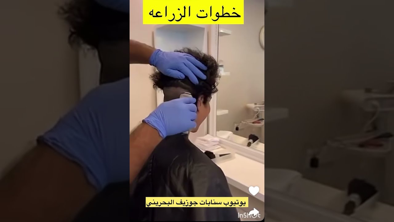 خطوات زراعه شعر جوزيف👍🏼/ ٢٠٩٣ سنابات جوزيف البحريني