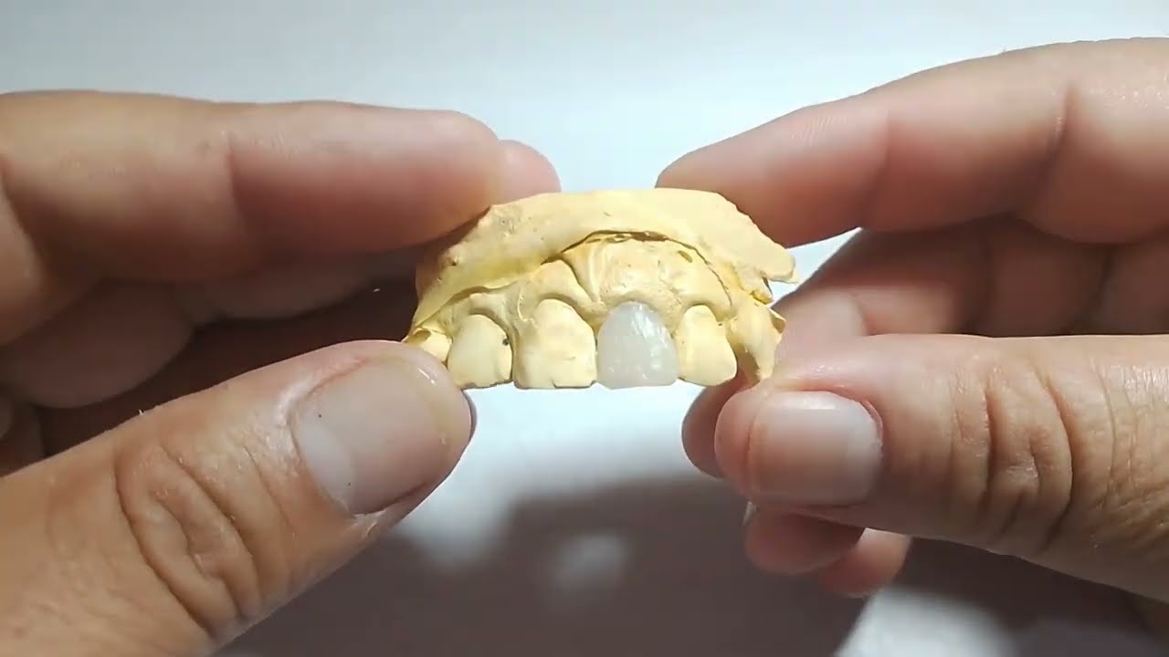 PERNO MUÑON!!!! COMO ADAPTAR PERFECTO