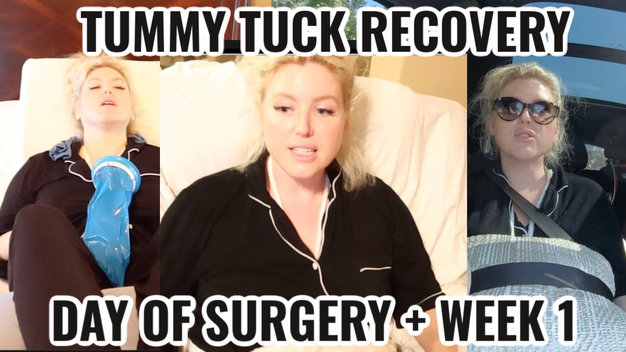 TUMMY TUCK SERIES: EPISODE 2 - DAY OF SURGERY + WEEK 1 OF RECOVERY